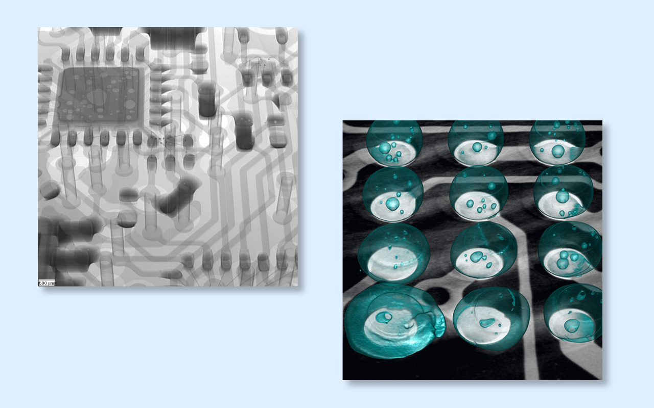 4. 2D vs 3D CT X-ray Which One Do You Really Need? 4. 2D vs 3D CT röntgen Melyikre van szüksége igazán?