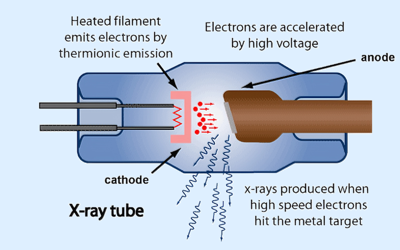 2. What X-ray Technology Actually Does 2. Mit csinál valójában a röntgentechnológia?